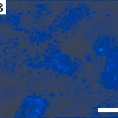 -DAPI staining: (A) MSC stained with DAPI; (B) renal cortex without MSC ...