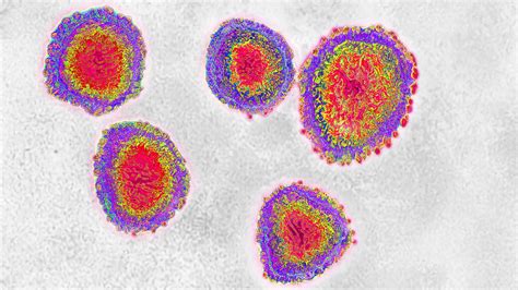 Confirman Primeros Casos De Coronavirus Covid 19 En México Uno En Cdmx