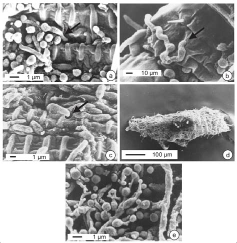 Scanning Electron Micro Graph Demonstrated Infection Processes Of Download Scientific Diagram