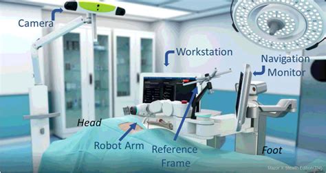 Navigation And Robotics In Pediatric Spine Surgery Journal Of The