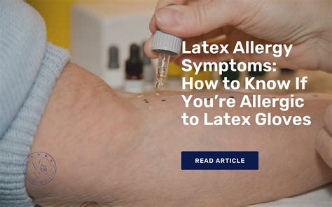 Latex Allergy Symptoms How to Know If You’re Allergic to Latex Gloves ...