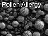 Pollen Allergy Types (Hold) - Patient Education