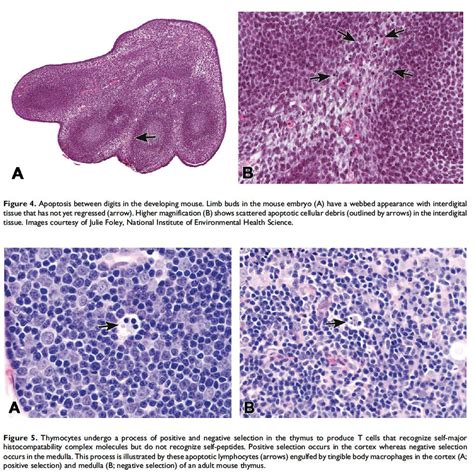 Recommendations From The Inhand Apoptosisnecrosis Working Group