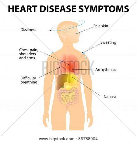 Heart Disease Vector & Photo (Free Trial) | Bigstock