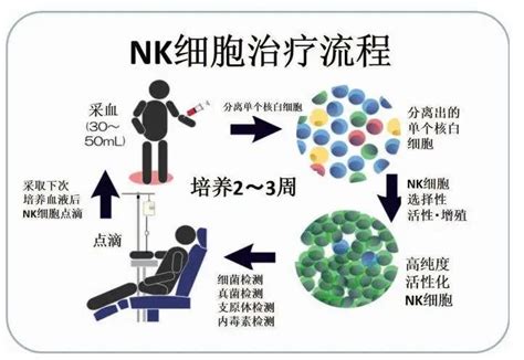 细胞免疫疗法 肿瘤细胞免疫治疗的新方向 CAR NK细胞疗法 无癌家园