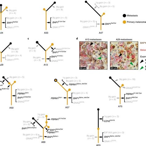 The Evolution Of Metastatic Uveal Melanoma ‘other Cnas Include