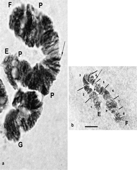 Salivary Gland Chromosome Ef And G Of Stictochironomus Sticticus A