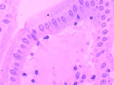 Simple Columnar with Microvilli