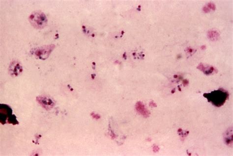 Imagem Gratuita Micrografia Mostra Jovem Crescendo Vivax Trophozoite Anel Palco