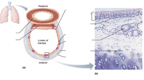 Trachea Diagram Diagram | Quizlet