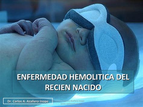 Enfermedad Hemolitica Del Recien Nacido Ppt