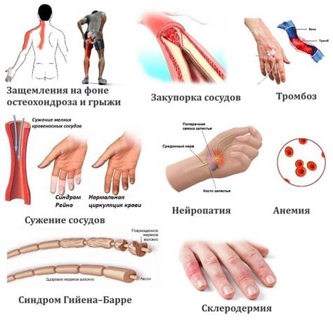 Немеют пальцы рук причина и что делать лечение народными средствами