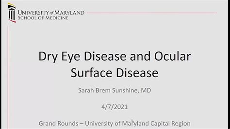 Dry Eye Disease And Ocular Surface Disease Youtube