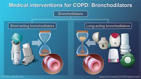 Short-acting, or quick relief, bronchodilators can be prescribed as ...