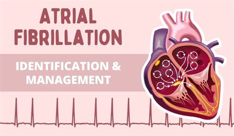 Vagal Maneuvers: How to Stop your Patient’s SVT | Health And Willness