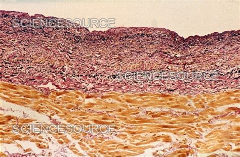 LM of Atrial Endocardium | Stock Image - Science Source Images