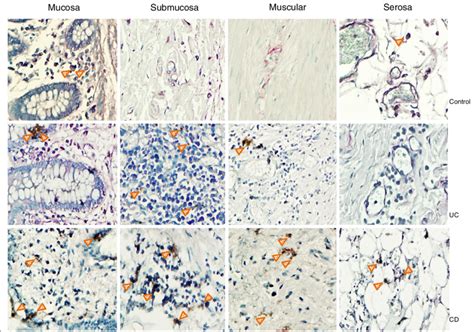 CARD15 Protein Expression In Colonic Tissue Representative