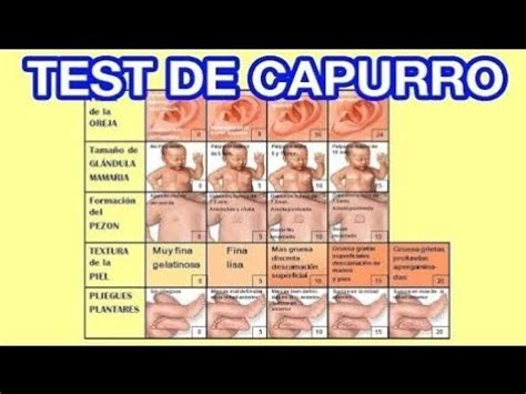 Test De Capurro Que Es Para Que Sirve Todo Acerca Del Tema