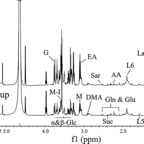 Representative H Nuclear Magnetic Resonance Nmr Spectra Of Serum