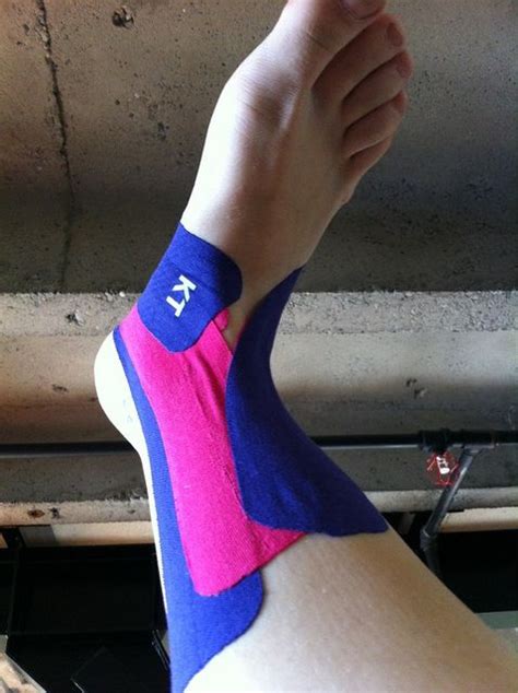 How To Tape An Ankle For Running