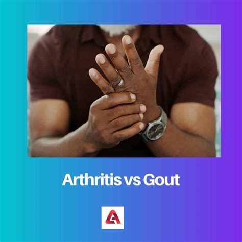 Arthritis vs Gout: Difference and Comparison