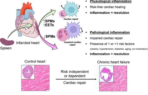 Inflammation And Resolution Signaling In Cardiac Repair And Heart