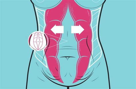 Di Stase Abdominal O Que Como Identificar Prevenir E Tratar