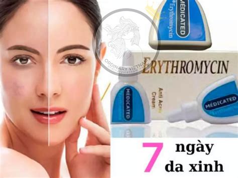 Kem Trị Mụn Erythromycin Của Nhật được ưa Chuộng Hiện Nay Ordinary