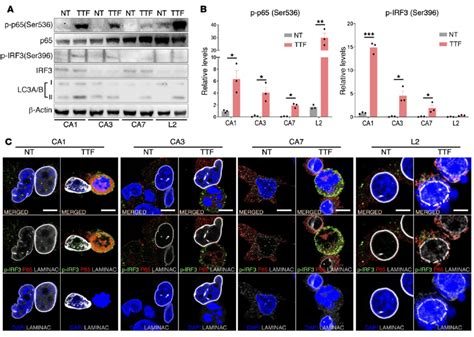 Ttfields Activate The Cgas Sting Inflammasome In Gscs See