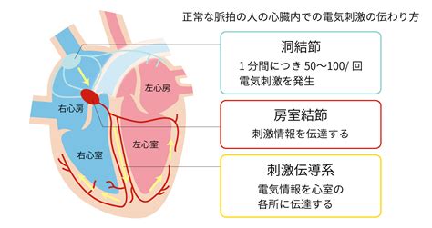 徐脈とは｜症状・原因・治療法について解説 不整脈の名医