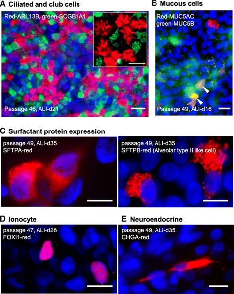 Characterization Of An Immortalized Human Small Airway Basal Stem