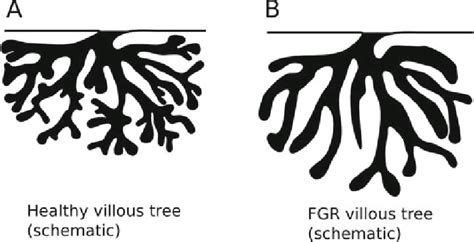 Schematic Representation Of Single Fetal Villous Trees In The Placenta Download Scientific