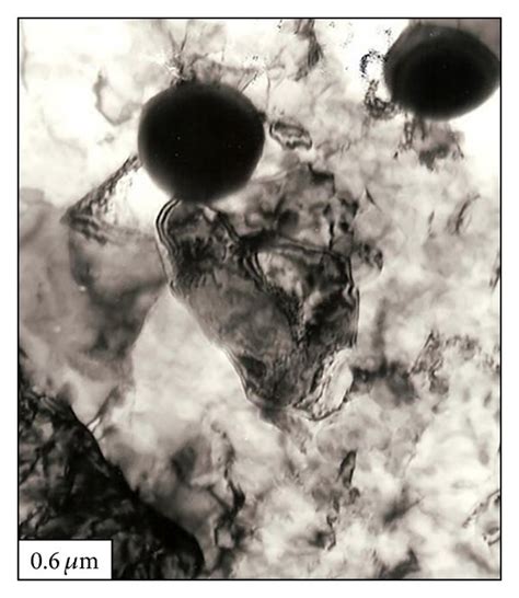 Tem Micrographs Of An Dhs Sample Showing Distribution Of Deformed