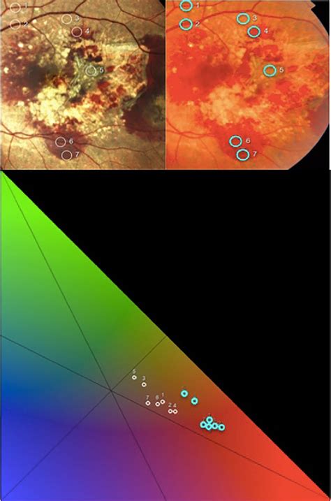 Figure 5 From A Comparison Between A White LED Confocal Imaging System