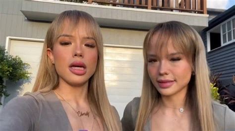 Beda Nasib Dea Onlyfans Dengan The Connel Twins Ini Kisah Si Gadis Kembar Berdarah Indonesia