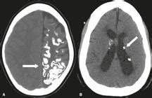 Scielo Brasil Classification And Clinical Significance Of