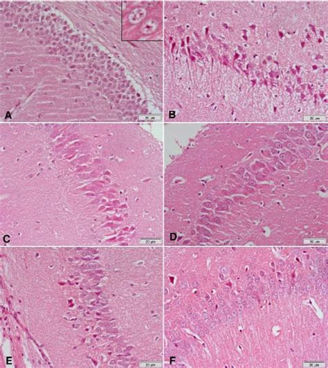 Figure From Curcumin Modulation Of L Dopa And Rasagiline Induced