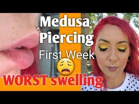 Medusa Piercing Healing Process