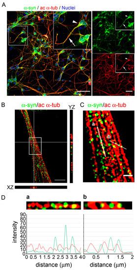 Ijms Free Full Text Acetylated α Tubulin And α Synuclein