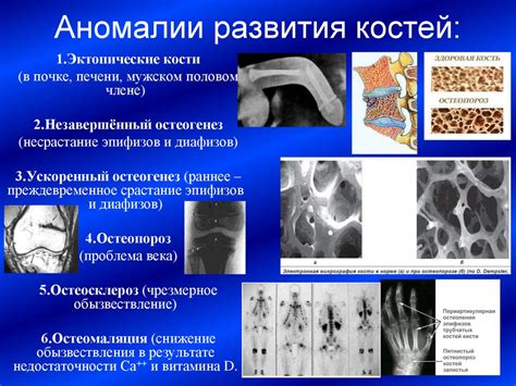 Функциональная анатомия костной системы - презентация онлайн