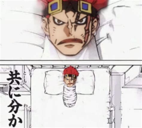 Why The Bias? When Kidd loses his arm to a YC he's a bum. When Shanks ...