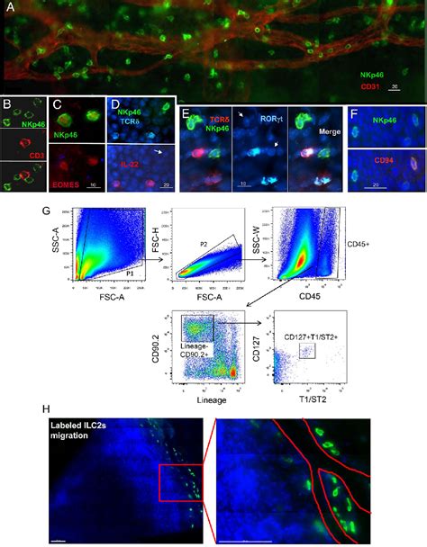 Figure 5 From Resident Innate Immune Cells In The Cornea Semantic Scholar