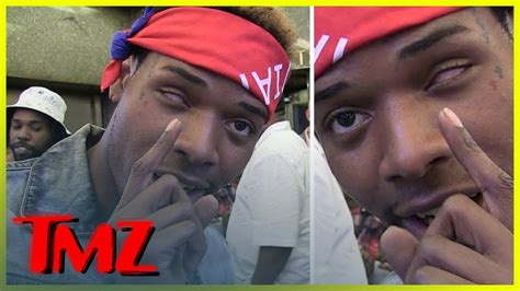 #WellDamn: Fetty Wap Clears Up Confusion About Missing Eye & Shooting ...