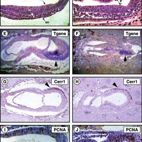 Histology Of Mutant Ugcg Embryos E7 5 Embryos Were Obtained From Timed