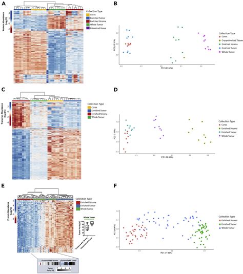 Extensive Three Dimensional Intratumor Proteomic Heterogeneity Revealed