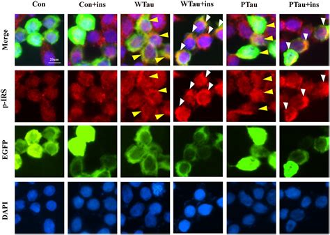 Frontiers The Identities Of Insulin Signaling Pathway Are Affected By