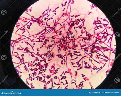 Yeast Cells and Hyphae in Gram Stain Fine with Microscope. Stock Photo - Image of cell ...