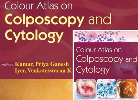 Color Atlas Colposcopy Cytology Sai Niwas Health Care