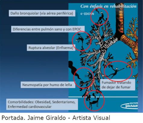 Fisiopatología Del Enfisema