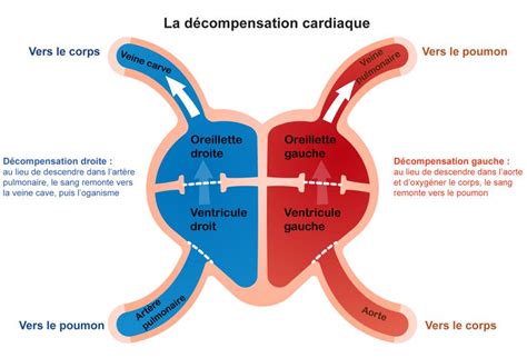 La D Compensation Cardiaque Chez La Personne G E Cap Retraite